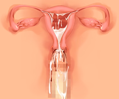 135
