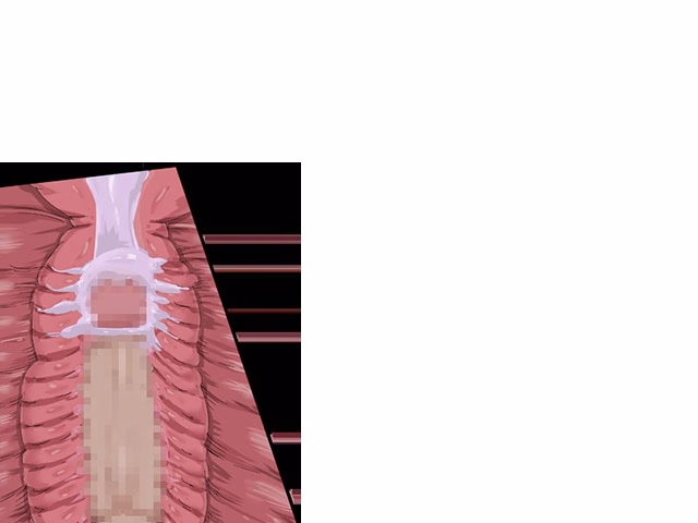 ev_kobura_ct03