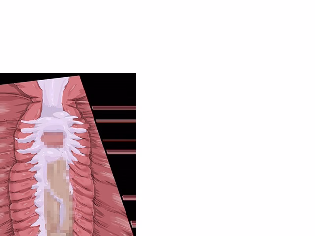 ev_kobura_ct04