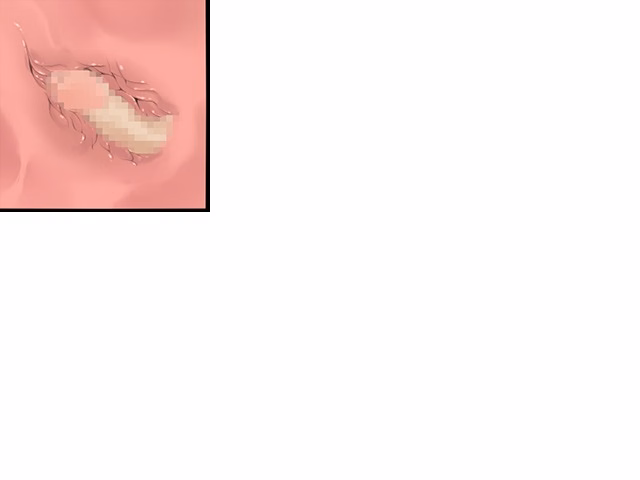 ev_lamia_ctb01