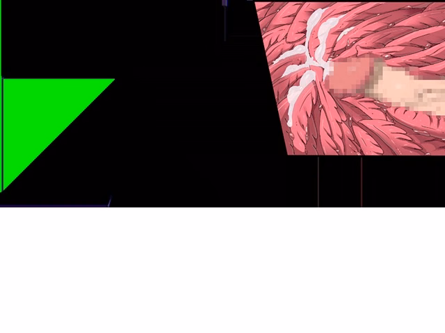 ev_mdg_ct32