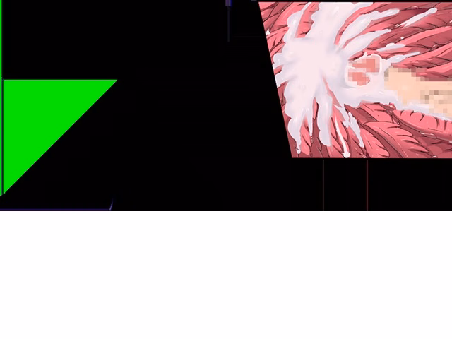 ev_mdg_ct34
