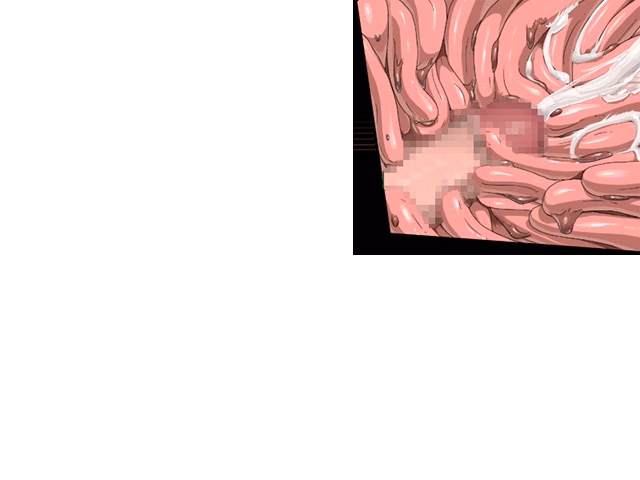 ev_meda_ct03